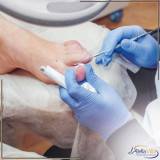 tratamento para unhas encravadas e infeccionadas Jockey Clube